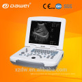 China fabricante CE ISO Laptop médico portátil ultra-som doppler colorido